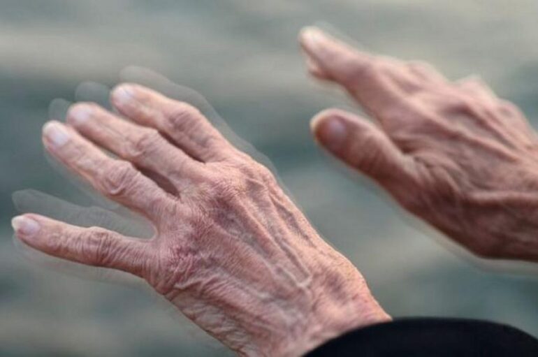 Παγκόσμια Ημέρα κατά της Νόσου του Πάρκινσον